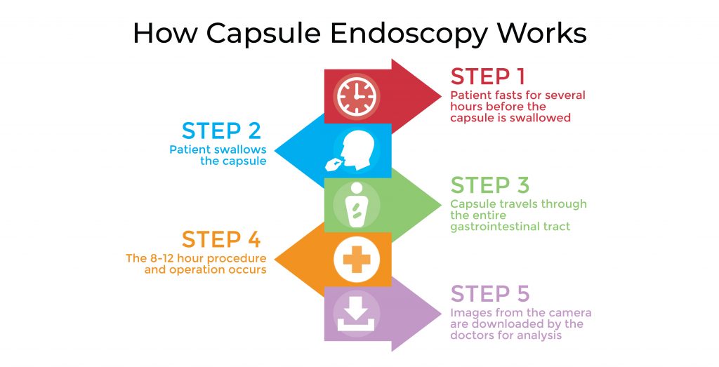 How Capsule Endoscopy Works